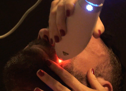 Clear & Brilliant Treatment with Cameron Byrnes for the Face of Man Experience episode